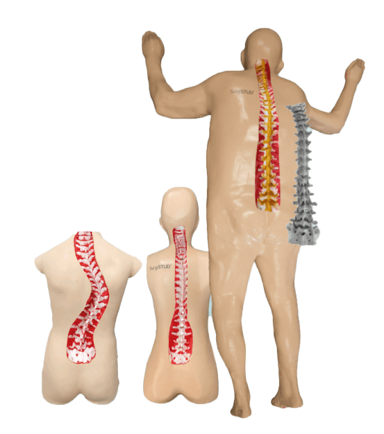 Expanding Surgical Possibilities for Patients of all Body Types
