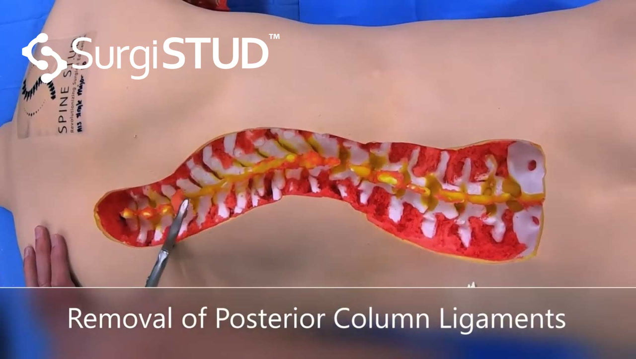 Posterior Column Ligaments