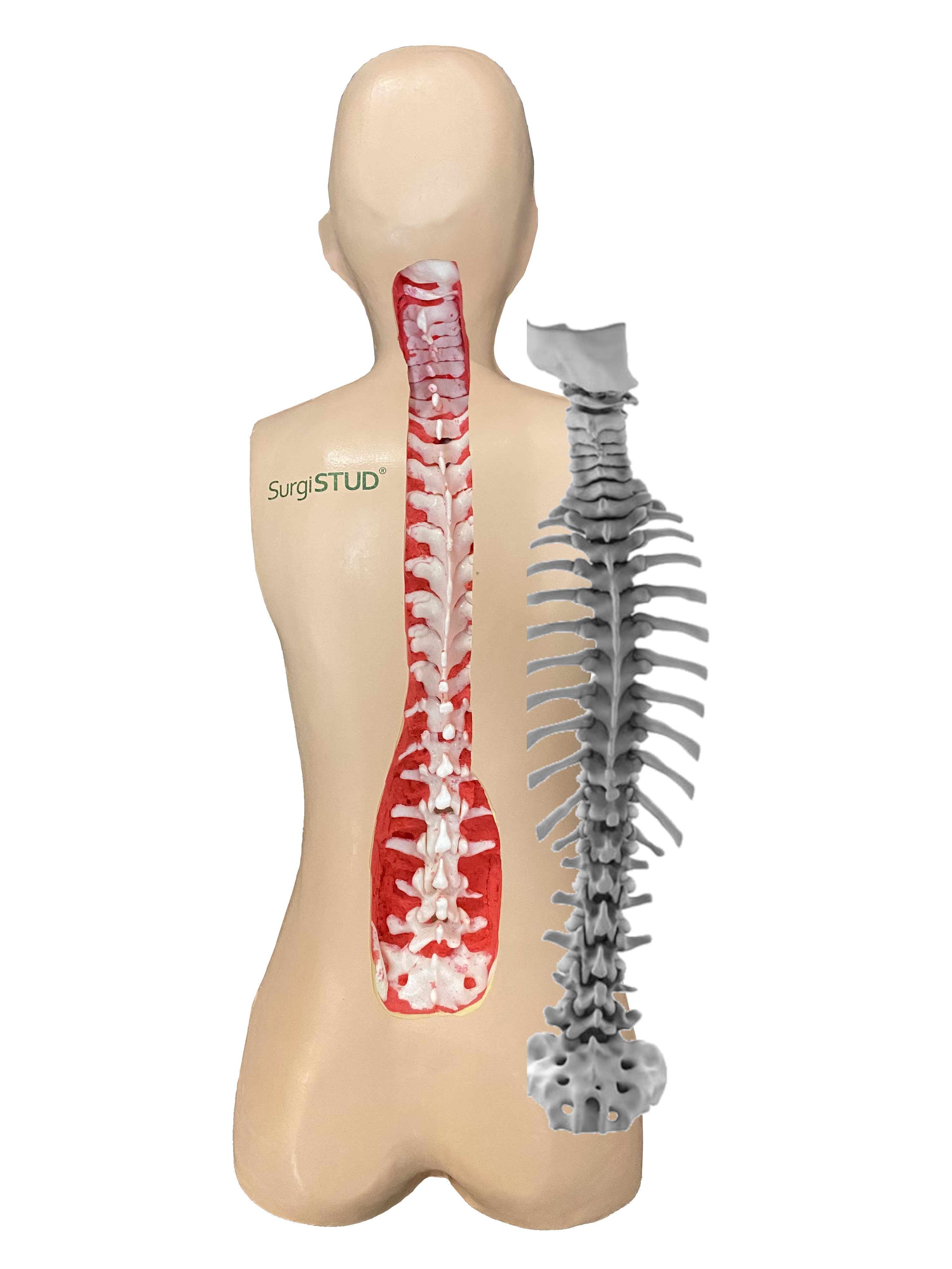 Revolutionizing Pelvic Trauma Training with SurgiSTUD's Advanced Solutions