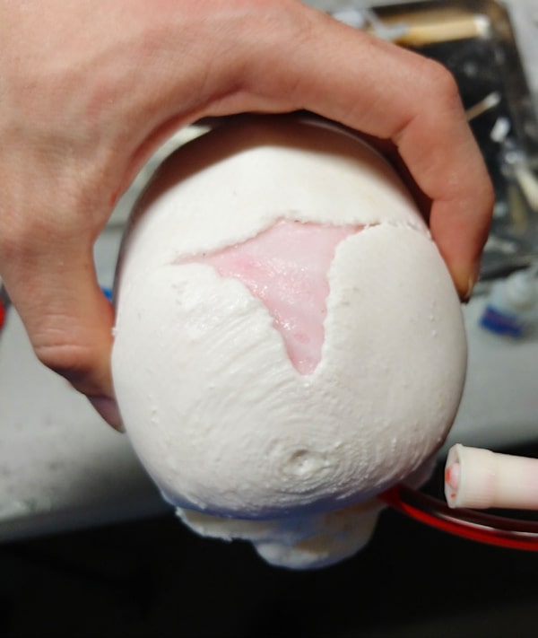 Custom STUDs for Pediatrics Deformities