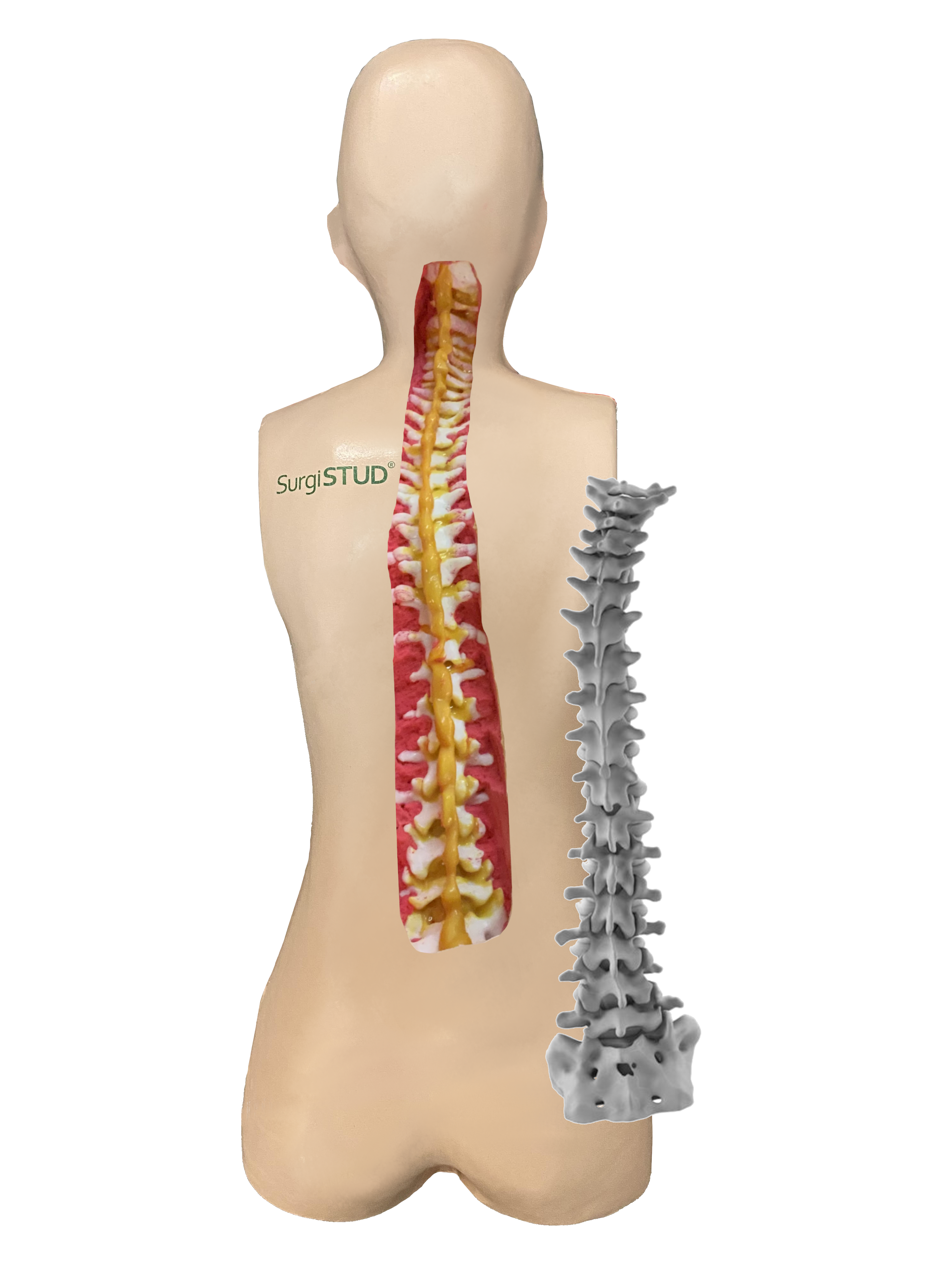 Adult Degenerative Spine