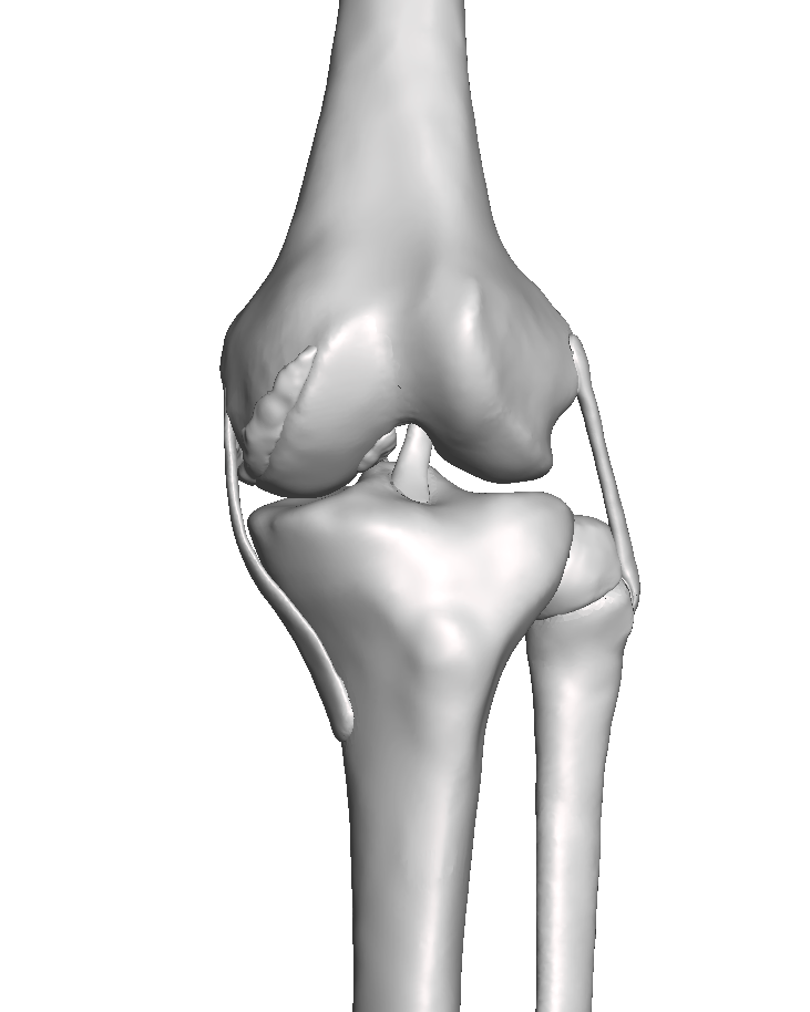 Zimmer PKA Knee