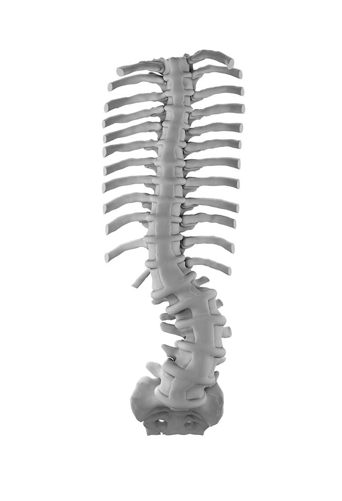 Adult Degenerative Scoliosis Lateral Approach Bundle