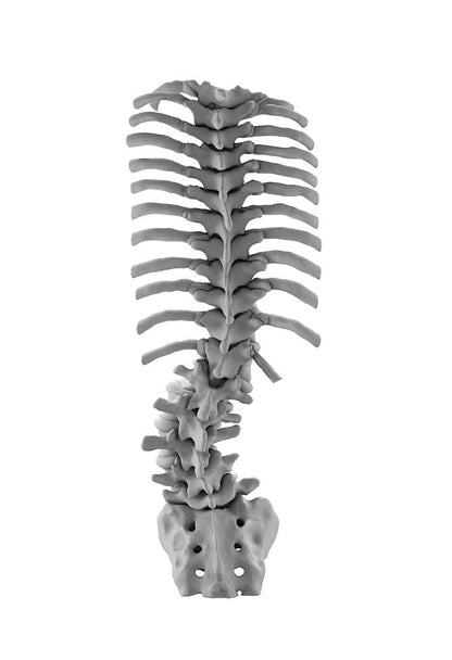 Adult Degenerative Scoliosis