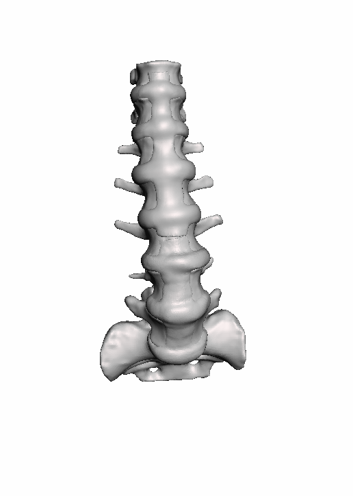 Adult Normal Lumbar Spine