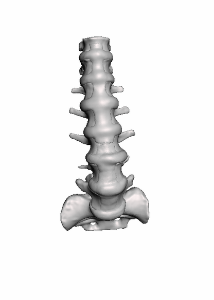 Adult Normal Lumbar Spine