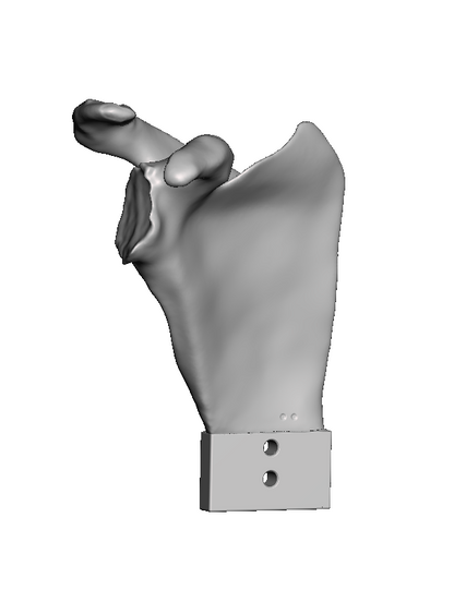 ROSA B2 Scapula Bundle