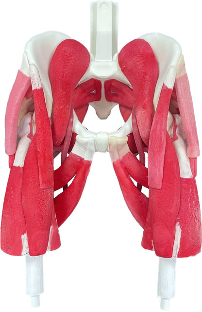 Comprehensive Bilateral Hip – Casted