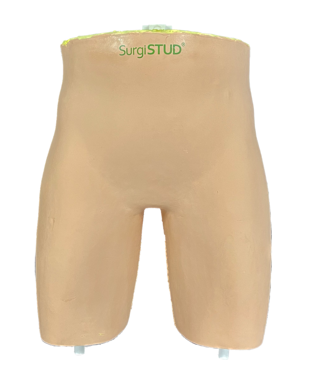 Comprehensive Bilateral Hip – Casted