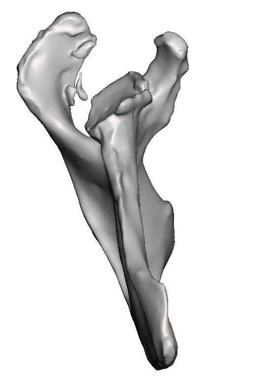 C2 Deformity Base Model