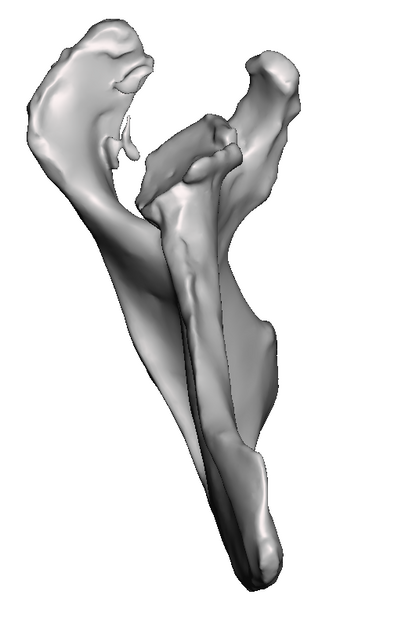 C2 Deformity Base Model