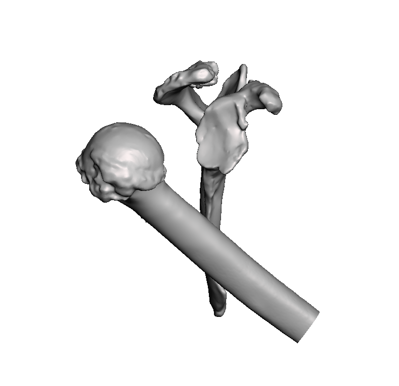 C2 Deformity Base Model