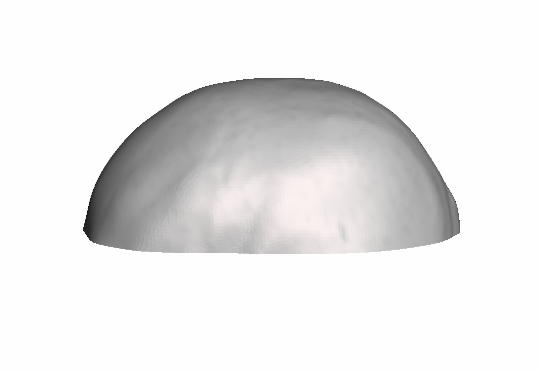 Calvarium