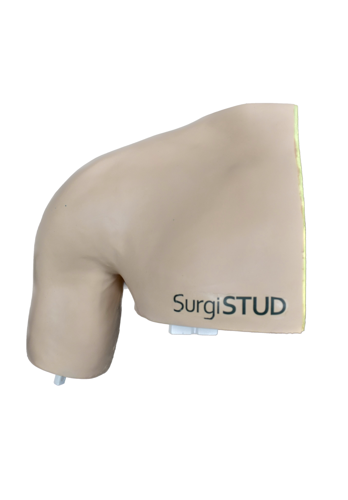 Comprehensive Shoulder – Casted