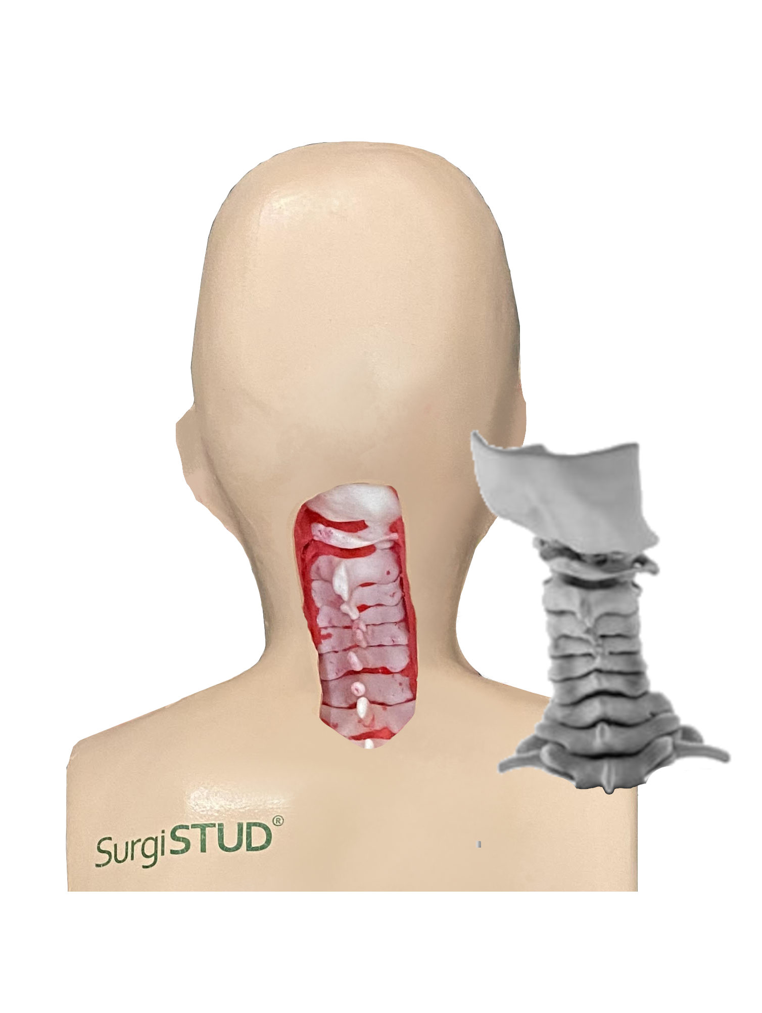 Normal Cervical Spine