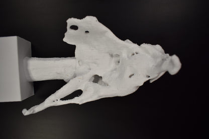 Mid Femur Amputee 2