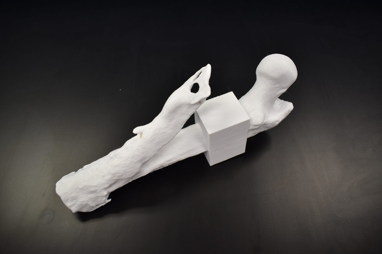 Mid Femur Amputee 1