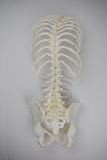 Adult Normal Anatomy Lateral Approach Bundle