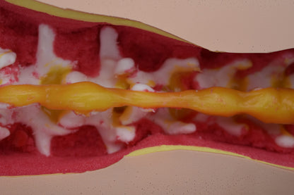 Occiput to Sacrum Trauma Spine