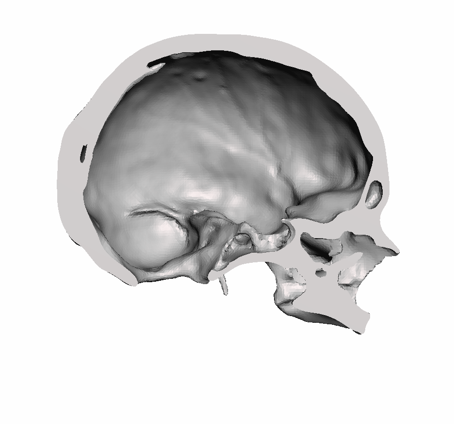 Left Hollow Skull