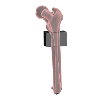 Mid Femur Amputee 3