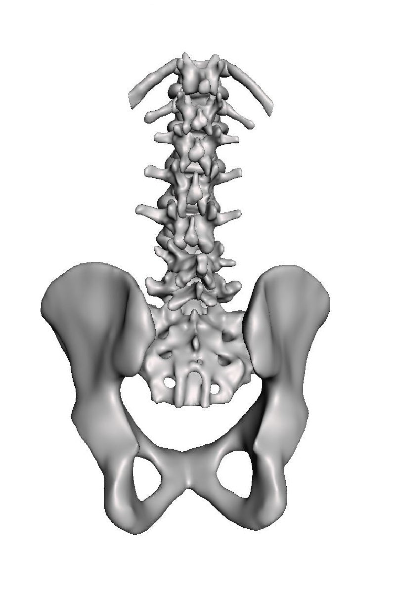 Lumbar Degenerative Spondylolisthesis