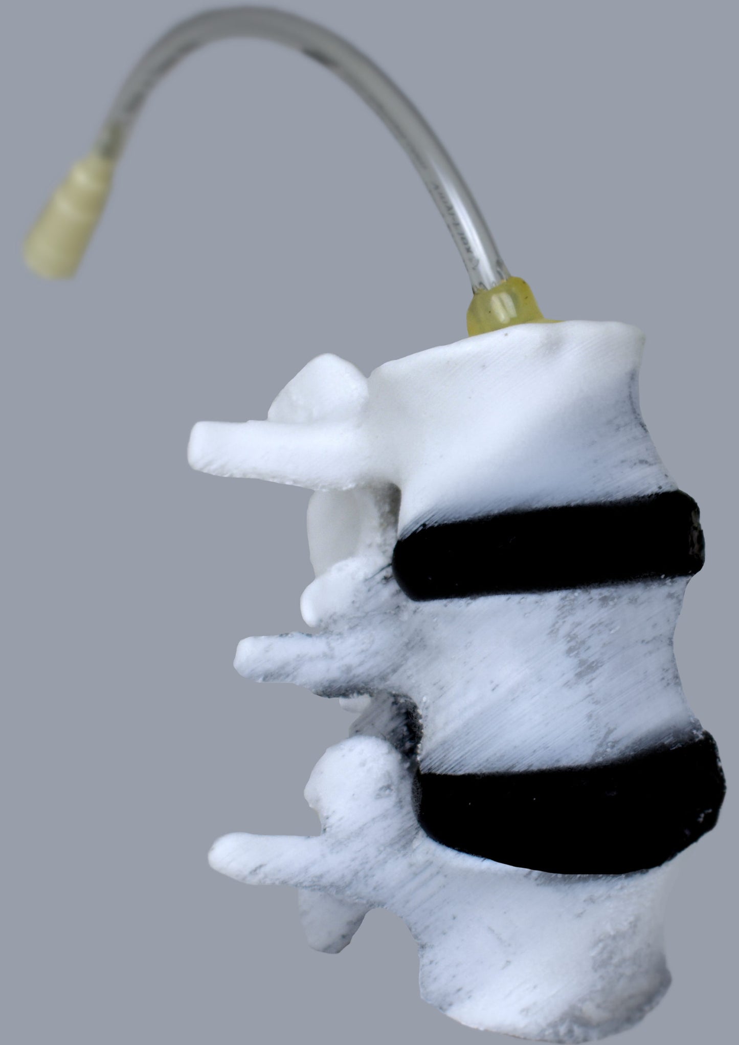 Vascularized Bone