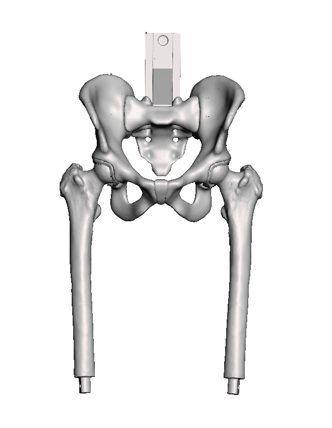 Base Model Bilateral Hip with Thicker Cortical Shell – Casted for ROSA Hip Training