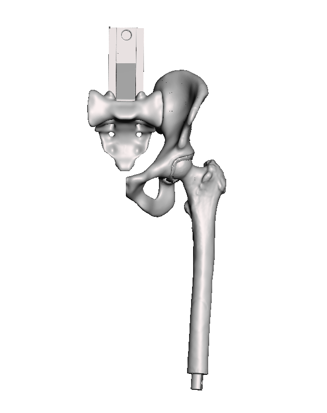 Normal Hip Base Model - Left