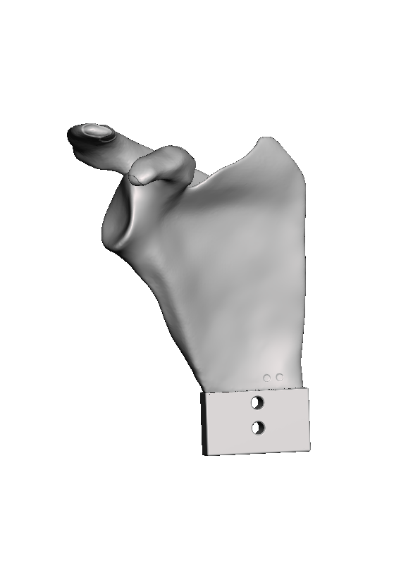 ROSA Normal Scapula Bundle