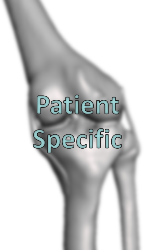 Custom/Patient Specific Knee