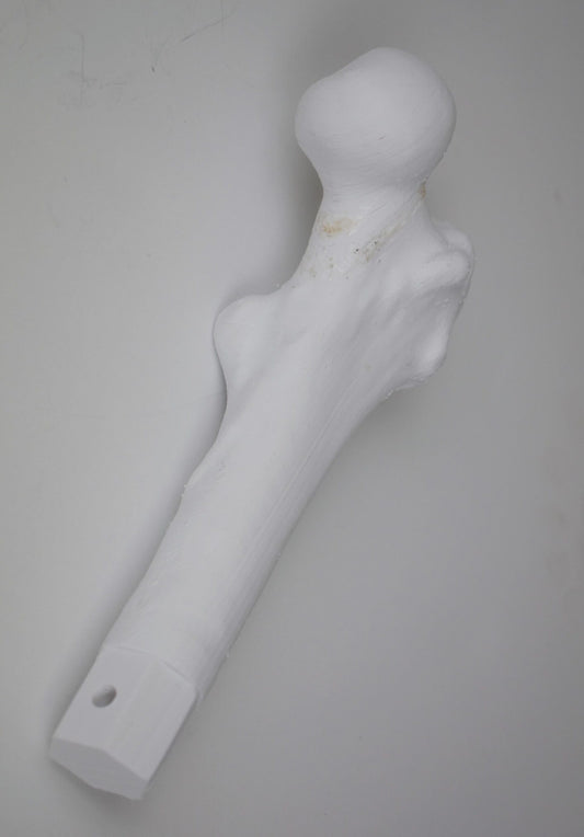 Proximal Femur Bundle