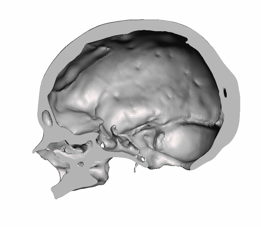 Right Hollow Skull