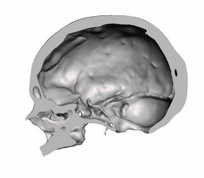 Right Hollow Skull