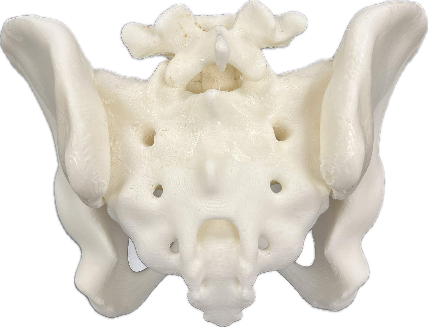Cornerloc Semi-Flexible SI v6 Cast