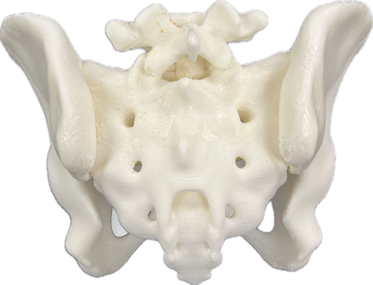 Cornerloc Semi-Flexible SI v6 Cast