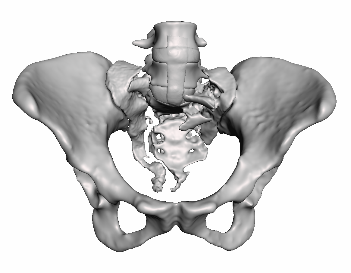 Sacral Fracture Bundle