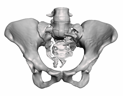 Sacral Fracture Bundle