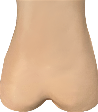 Cornerloc Semi-Flexible SI v6 Cast