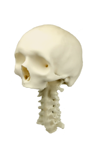 Adult Normal Anatomy Lateral Approach Bundle