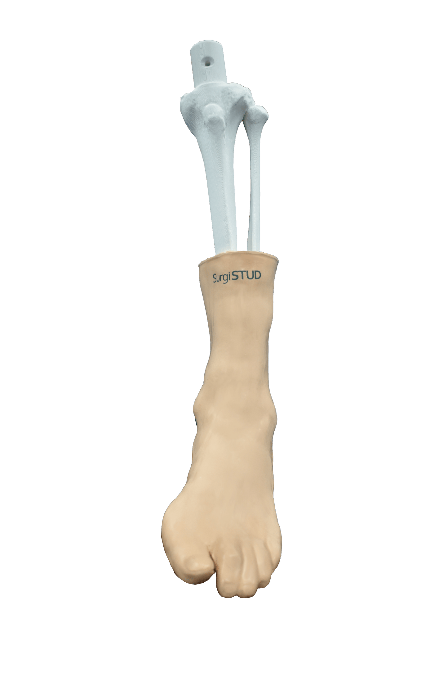 Comprehensive Ankle – Cast