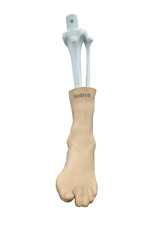 Comprehensive Ankle – Cast
