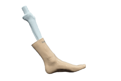 Comprehensive Ankle – Cast
