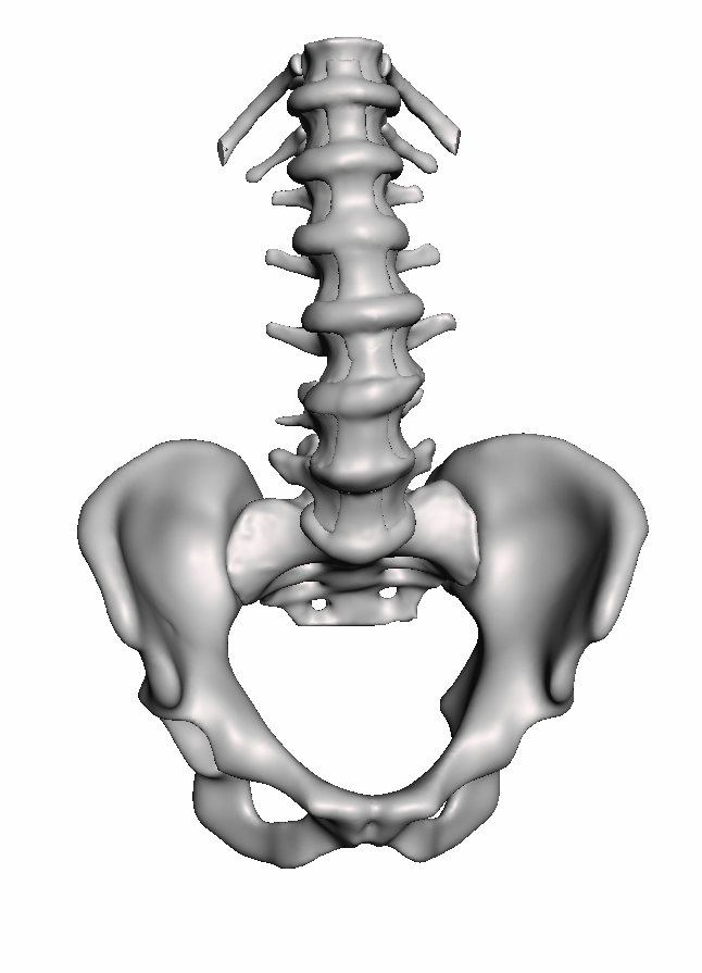 Spondylolisthesis 2
