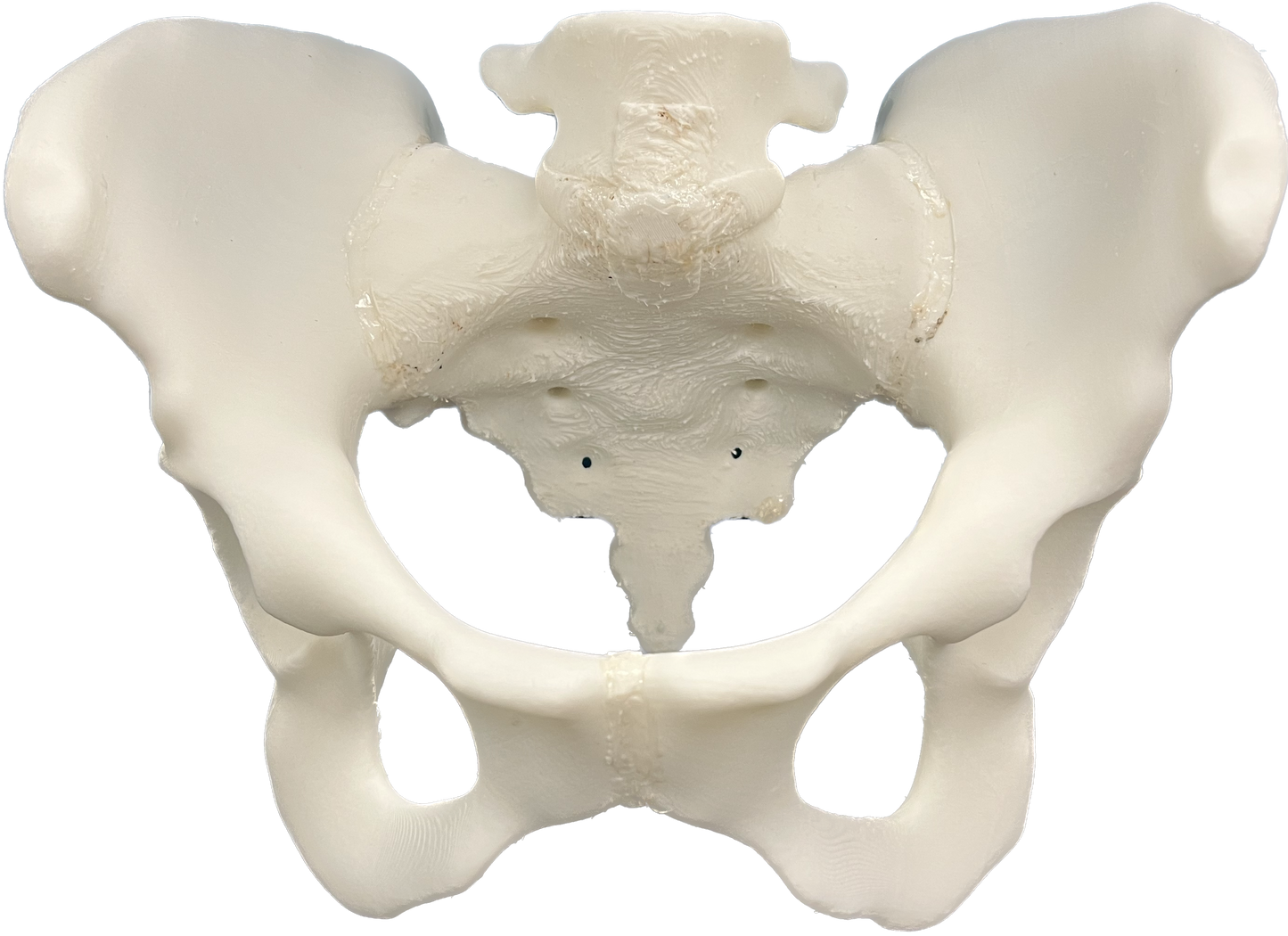 SI Joint Normal Anatomy