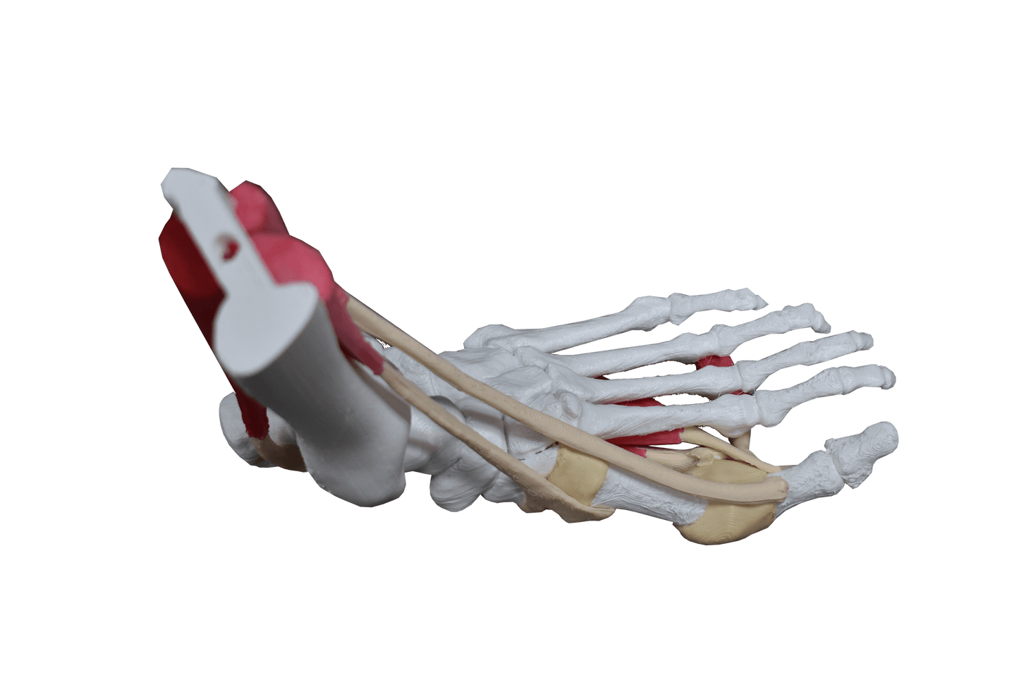 Comprehensive Bunion Foot – Uncast