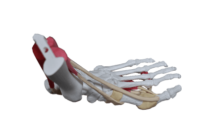 Comprehensive Bunion Foot – Uncast