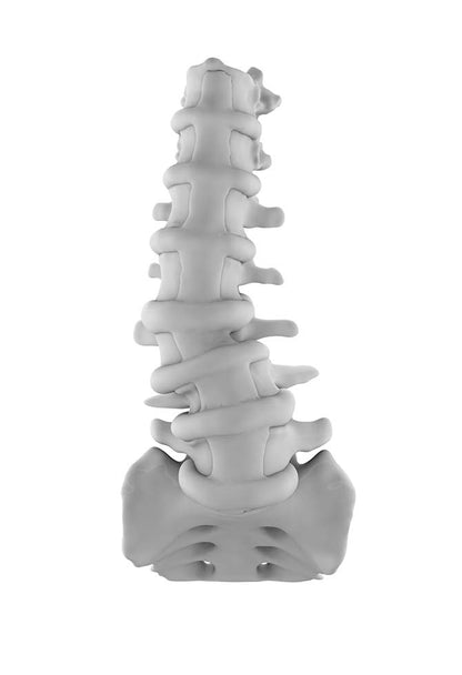 Lumbar Degenerative Scoliosis 1
