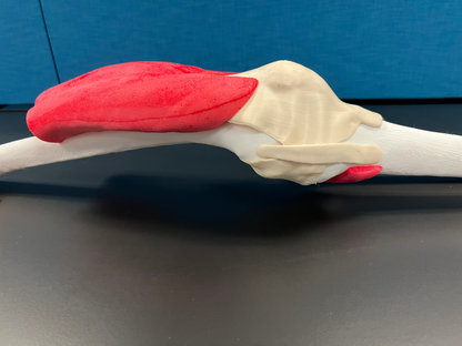 Comprehensive Normal Stryker Knee for Mako - Casted