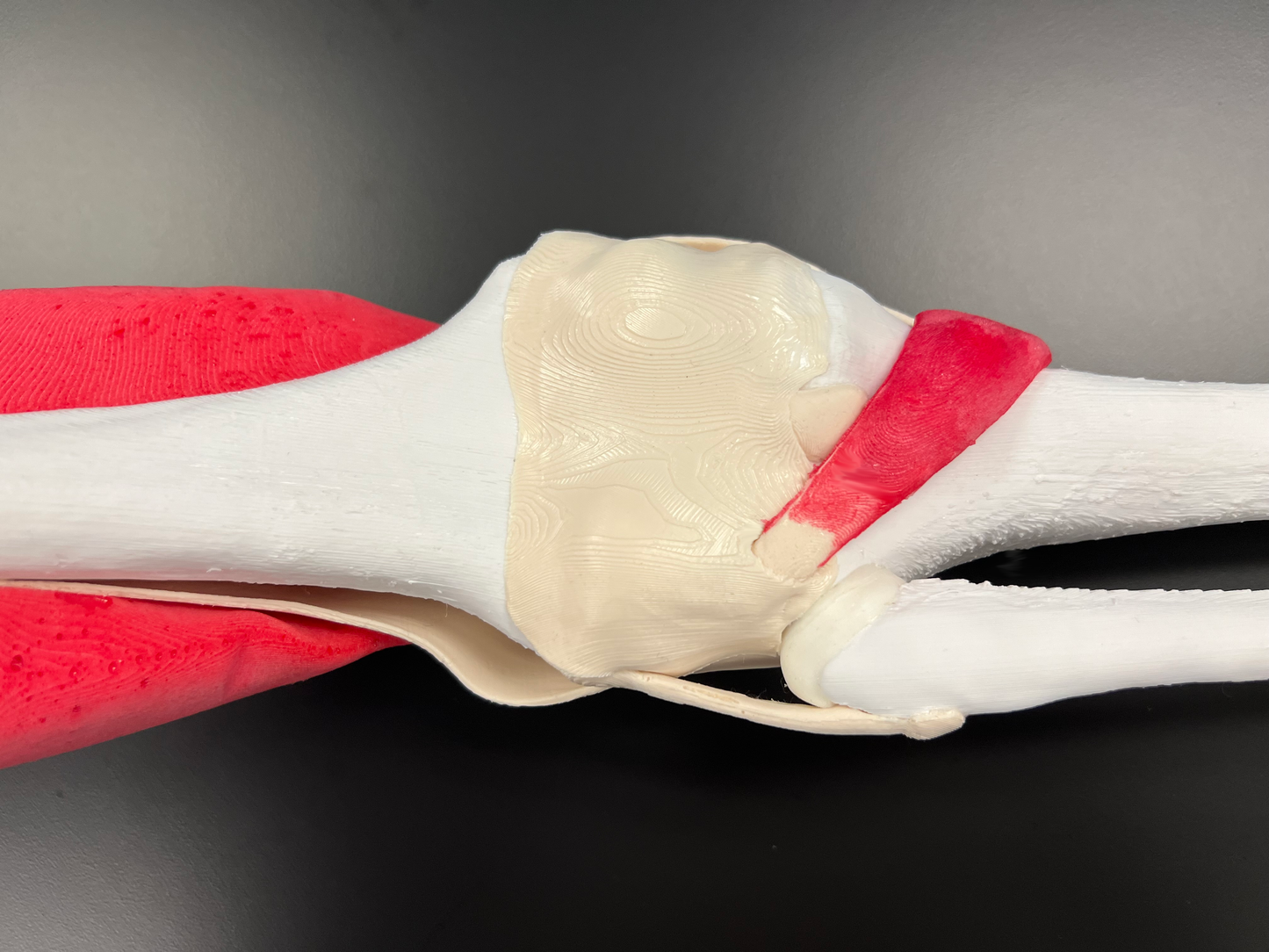 Comprehensive Knee – Uncast